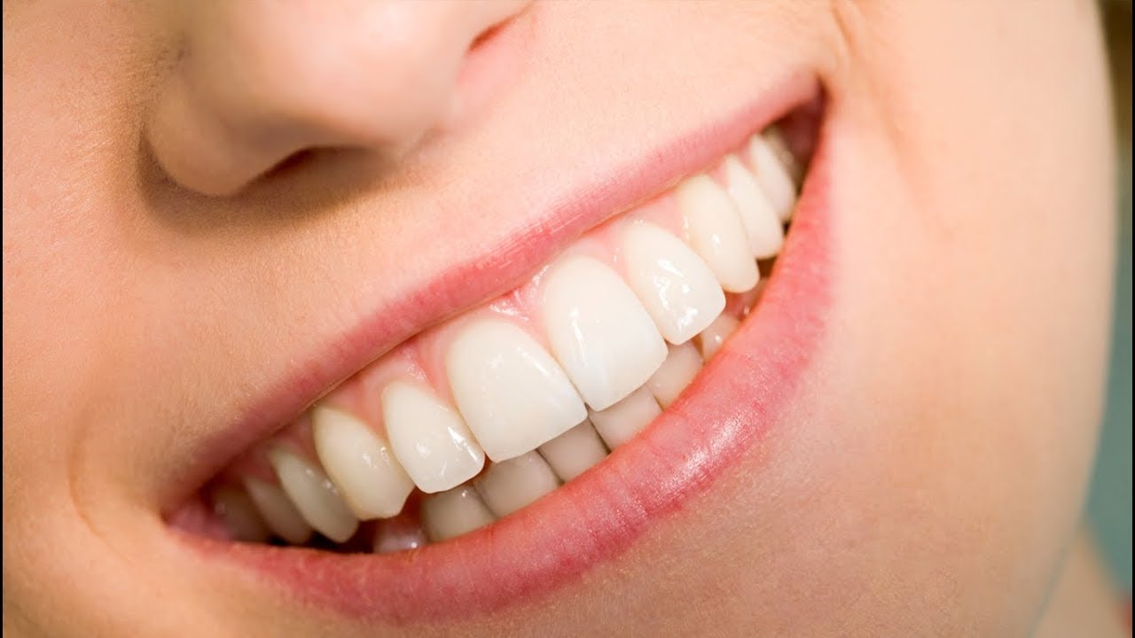 Diş Taşı Temizliği